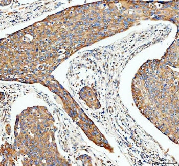 Transferrin Antibody