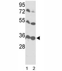 VDAC1 Antibody