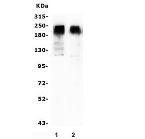 mGluR2 Antibody / Metabotropic Glutamate Receptor 2 / GRM2