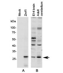Western blot A: N2a cell lysate overexpressing mouse Znrf1 and Blot B: mouse brain lysates (embryo E