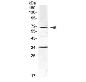Alpha 1 Fetoprotein Antibody / AFP