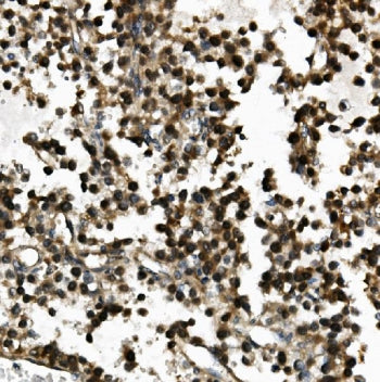USP44 Antibody