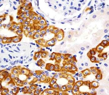 KRT19 Antibody / Cytokeratin 19