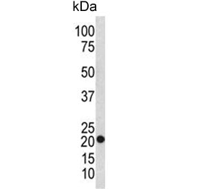 TAGLN Antibody / Transgelin / SM22 alpha