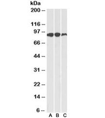 Western blot of human (A), mouse (B) and rat (C) adipose lysates with Aconitase 2 antibody at 0.1ug/