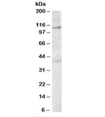 HPS3 Antibody