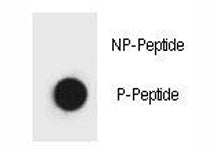 Phospho-Beclin-1 Antibody (pT119)