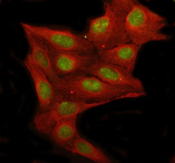 RFC1 Antibody