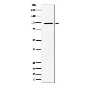 RPS6KA3 Antibody / Ribosomal protein S6 kinase alpha 3 / RSK2
