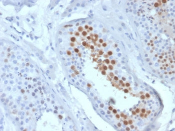 IHC staining of FFPE human testis tissue with KIF2C antibody (clone KIF2C/6519) at 2ug/ml. HIER: boi