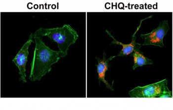 LC3B Antibody / MAP1LC3B (N-Terminal)