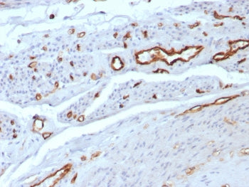 IHC staining of FFPE human uterus tissue with CD31 antibody (clone C31/8592R). HIER: boil tissue sec