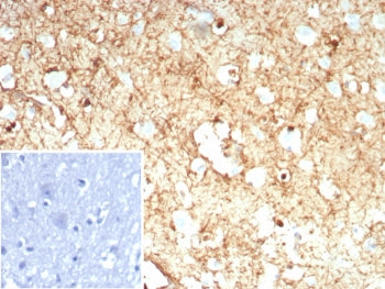 Glutamine Synthetase Antibody / GLUL