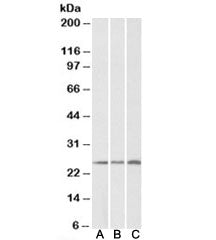 CSRP2 Antibody