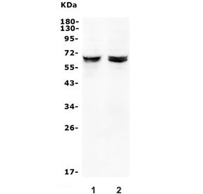 Western blot testing of human 1) A375 and 2) A431 cell lysate with JRK antibody. Predicted molecular
