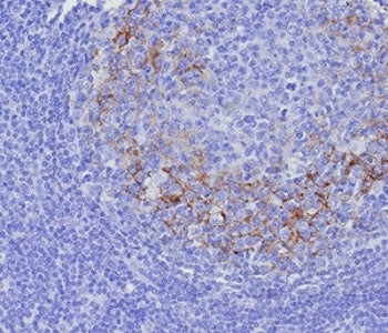 IHC staining of FFPE human tonsil tissue with CD23 antibody (clone FCER2/8237R). HIER: boil tissue s