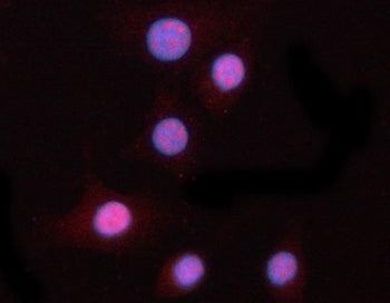 PPM1N Antibody / Probable protein phosphatase 1N