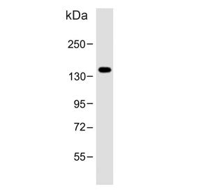 POTEE Antibody / POTE2
