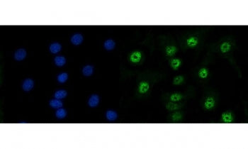 Immunofluorescent staining of FFPE human A549 cells with RAD50 antibody (green) and DAPI nuclear sta