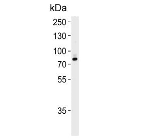 Exostosin 2 Antibody / EXT2