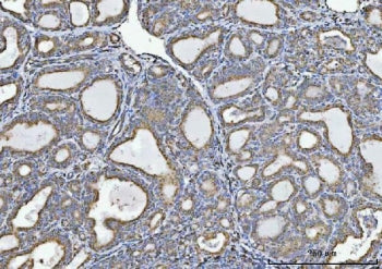 Glycine Decarboxylase Antibody / GLDC