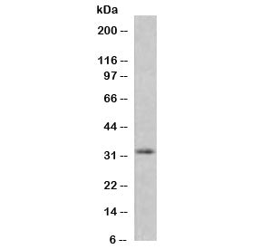 Western blot testing of human HeLa cell lysate with recombinant MTAP antibody (clone SMTP-1R). Expec