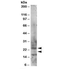RAB2 Antibody