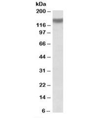 Western blot testing of mouse skeletal muscle lysate with ITGA11 antibody at 1ug/ml. Predicted molec