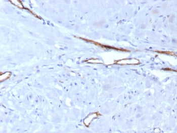 von Willebrand Factor Antibody / vWF