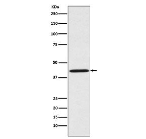 Sprouty 2 Antibody / SPRY2