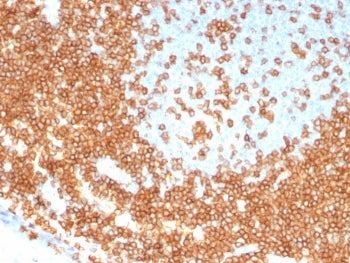CD3 epsilon Antibody