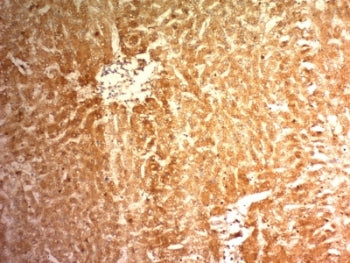 Glypican 3 Antibody / GPC3