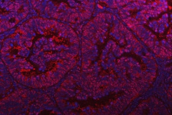 PSMD4 Antibody / ASF1 / RPN10 / S5A