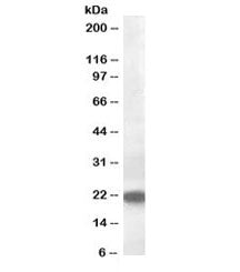 VPS25 Antibody