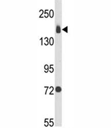 Integrin alpha 2 Antibody (ITGA2)