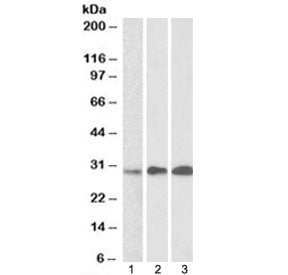 Western blot testing of human 1) thymus, 2) lymph node and 3) tonsil lysates with EFHD2 antibody at