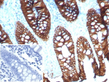 IHC staining of FFPE human colon tissue with CDH17 antibody (clone CDH17/8515R). Inset: PBS used in