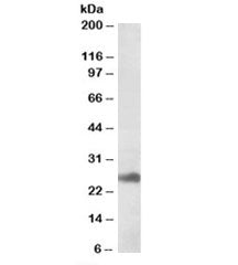Western blot testing of human liver lysate with DNAJB9 antibody at 1ug/ml. Predicted molecular weigh