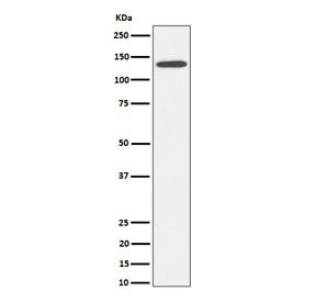 Western blot testing of human HepG2 cell lysate with CDH4 antibody. Expected molecular weight: 100-140 kDa depending on glycosylation level.