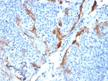 KRT16 Antibody / Cytokeratin 16