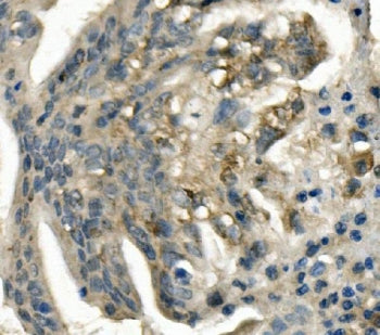 LDLR Antibody / LDL Receptor