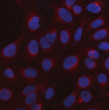 Immunofluorescent staining of FFPE human U-2 OS cells with 5-HT3C antibody (red) and DAPI nuclear stain (blue). HIER: steam section in pH6 citrate buffer for 20 min.