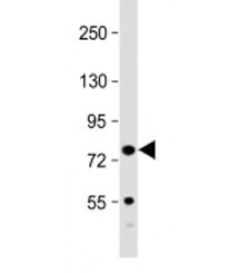 Kindlin-3 Antibody / URP2 / FERMT3