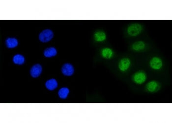 Immunofluorescent staining of FFPE human SiHa cells with RAD21 antibody (green) and DAPI nuclear sta