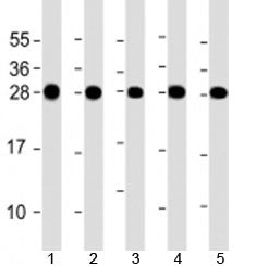 RPL14 Antibody / Ribosomal Protein L14