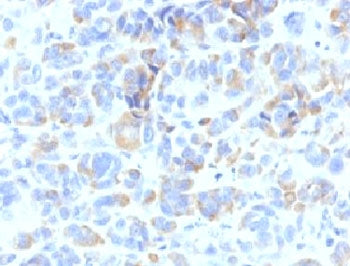 TRP1 / Tyrosinase-Related Protein-1 Antibody