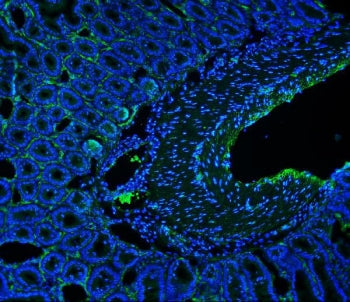 Cd146 Antibody / MCAM / MUC18