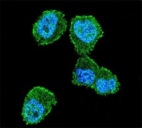 LKB1 Antibody (Liver Kinase B1)