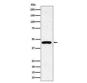 KRT19 Antibody / Cytokeratin 19