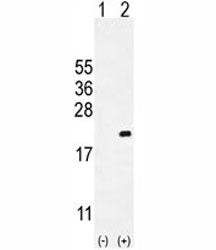 Western blot analysis of CDKN2C antibody and 293 cell lysate either nontransfected (Lane 1) or trans
